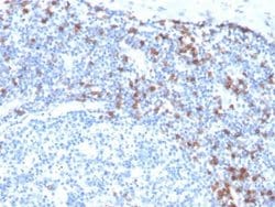 Integrin alpha E/CD103 Antibody (ITGAE/3904R) - Azide and BSA Free, Novus Biologicals 100 &mu;g | Buy Online | Novus Biologicals | Fisher Scientific